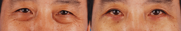 nʽ۴׌۾W(xu)(hu)“fe”