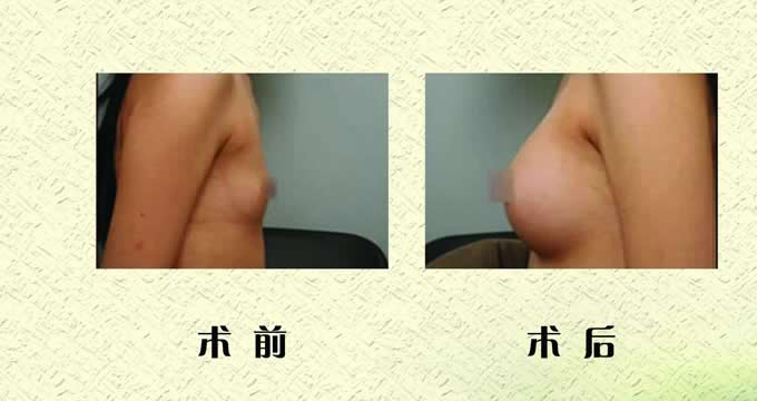 w¡غ鷿(li)Ȼ