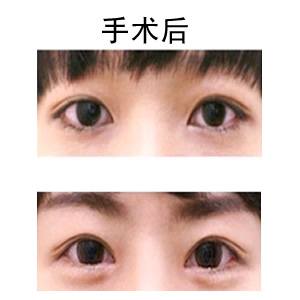 pƤǰ(du)Ƭ