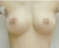¡ޏ(f)(du)Ƭ