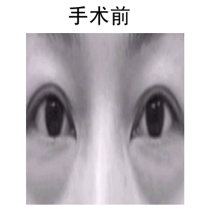 ۲֬ǰ󌦱Ƭ