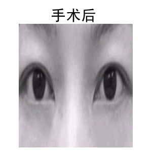 ۲֬ǰ󌦱Ƭ