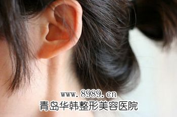 棗莊菜花耳整形