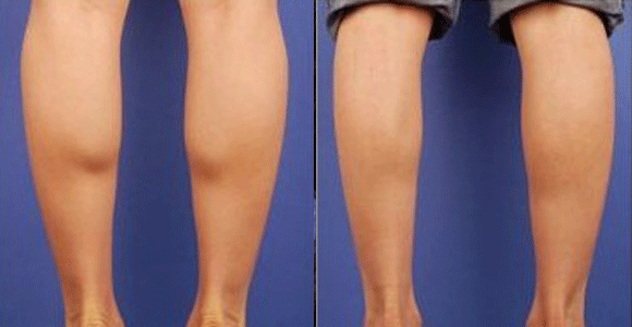uĂt(y)ԺݼС