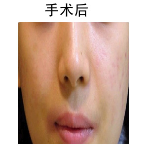 ʹ(f)l(f)