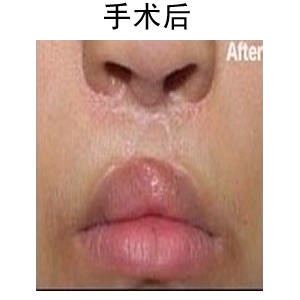 ޏ(f)