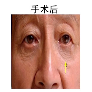 ۴ޏǰ󌦱Ƭ