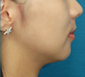 µ˄Q°