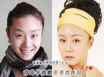 賈蓉漂唇美容效果前后對(duì)比圖