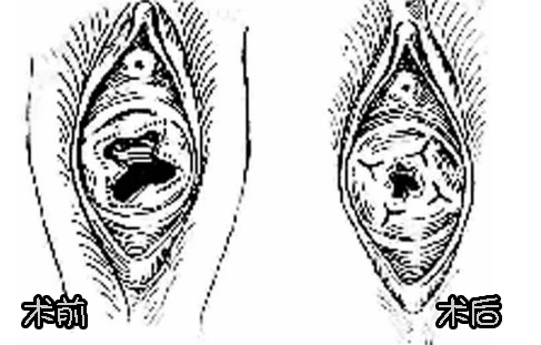 ̎ŮĤޏ(f)(du)Ƭ