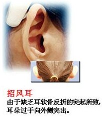L(fng)ʾD