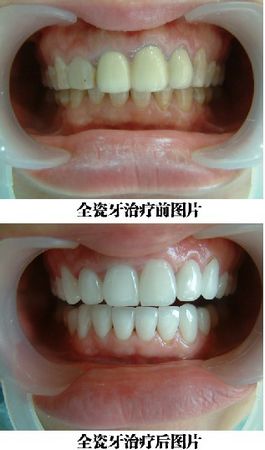 uһwȫX(qin)
