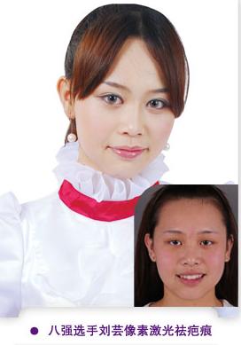 劉云整形