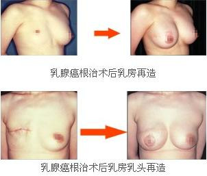 鷿ؽǰ󌦱ȈD