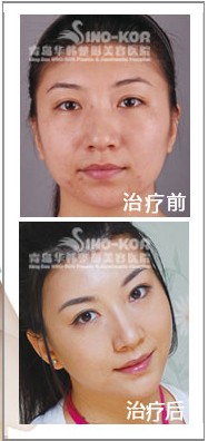 MЧǰ(du)ȈD