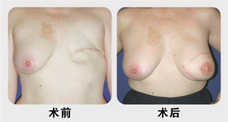 鷿ǰ(du)ȈD