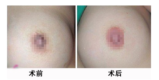 镞Ưtǰ󌦱ȈD