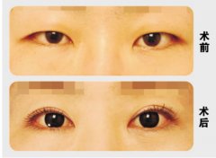 (xin)pƤǰ(du)ȈD