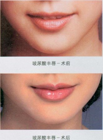 Sǰ(du)ȈD