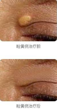 Sίǰ󌦱ȈD