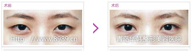 pƤgʬF(xin)ȻЧ