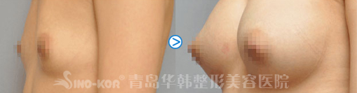 Sǰ(du)ȈD