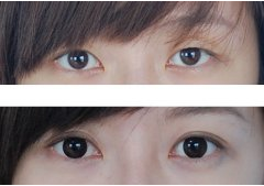 _(ki)۽ǰ(du)