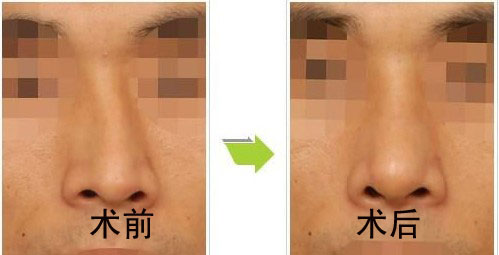 ǳCǰ(du)