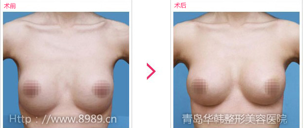 C鷿´ǰЧ(du)