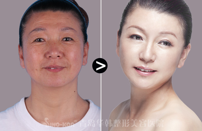 ⶾسǰЧ